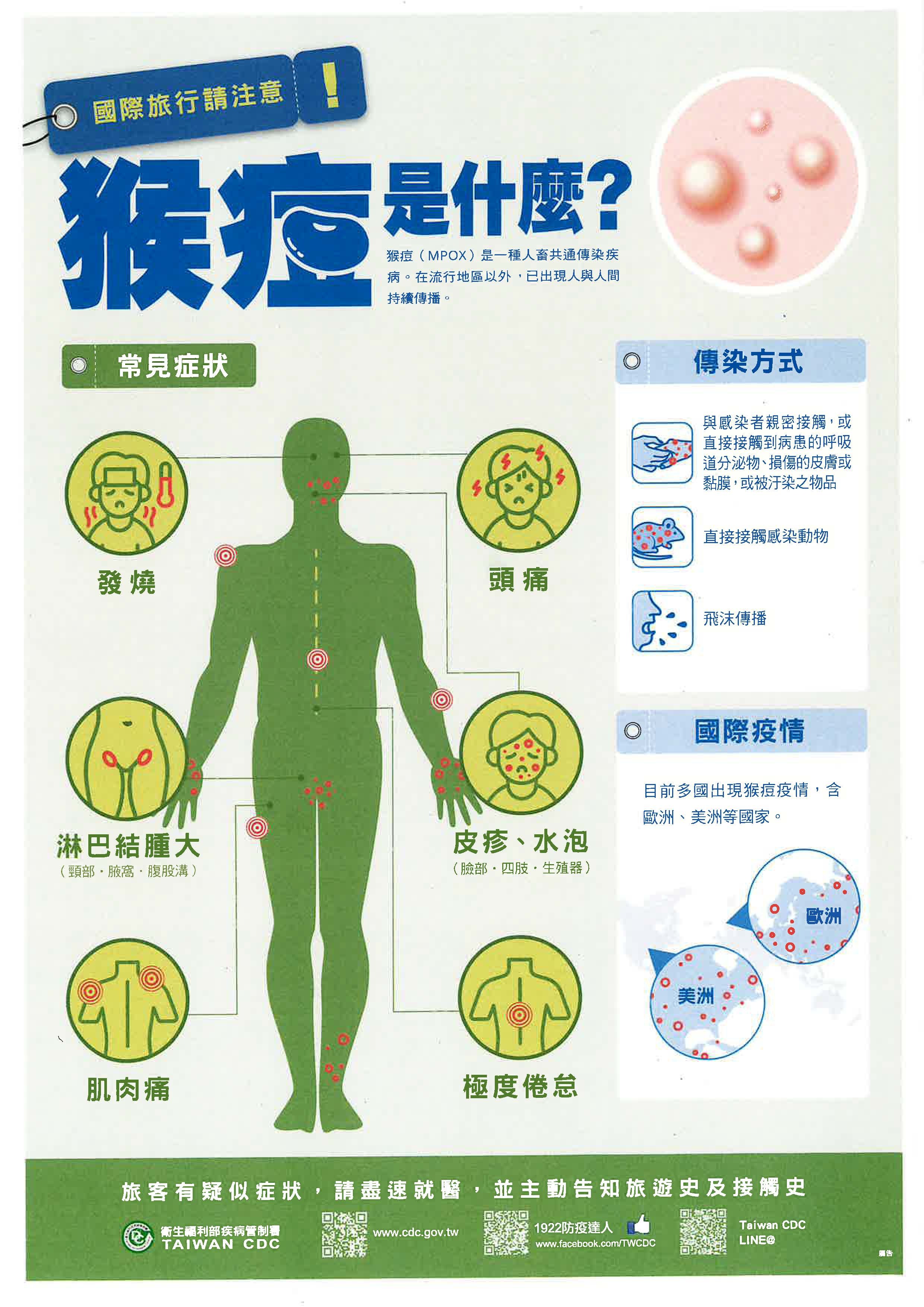 因應國內本土猴痘(Mpox)疫情防制相關事宜
