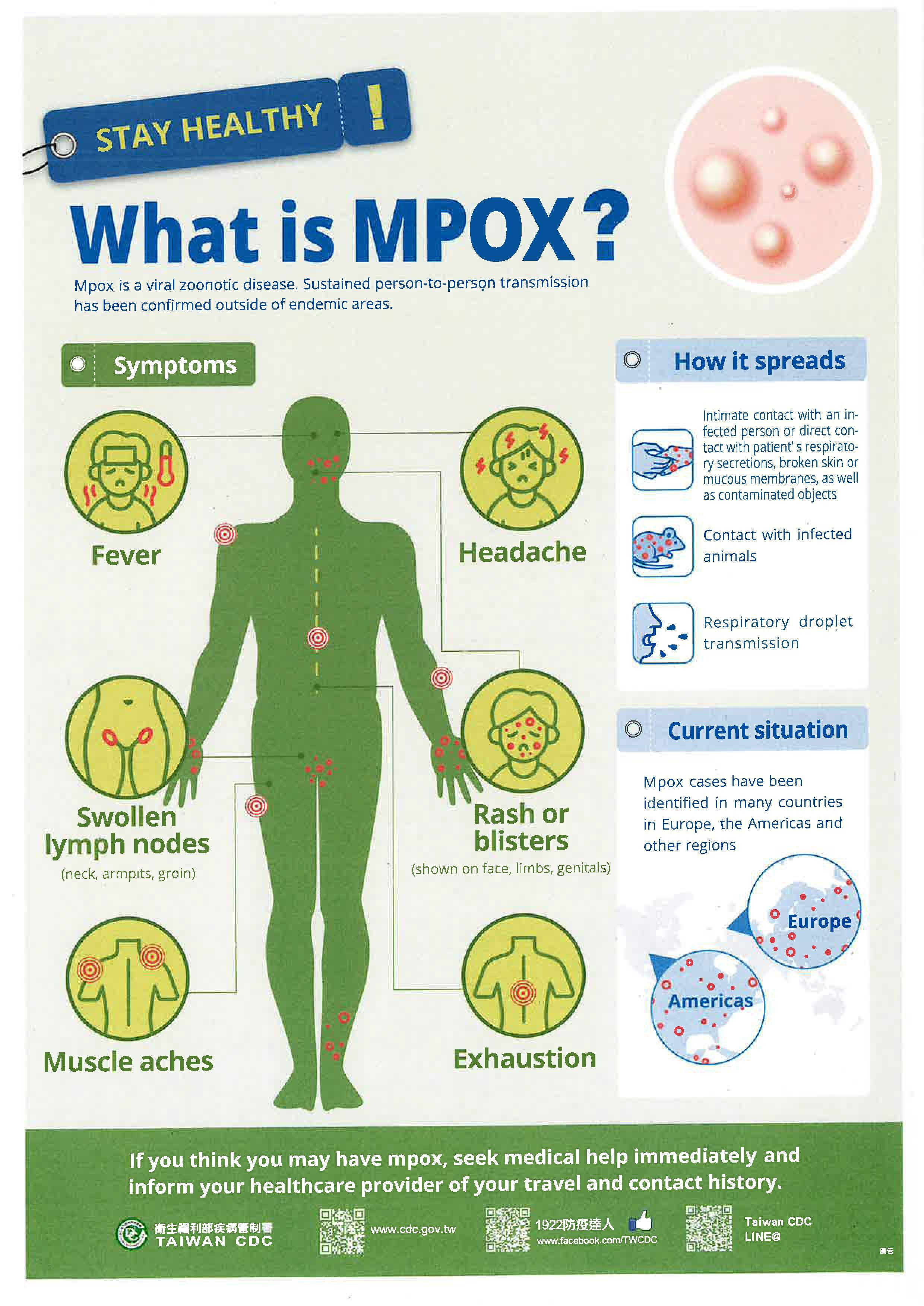 因應國內本土猴痘(Mpox)疫情防制相關事宜